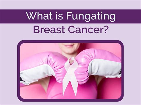 Fungating tumors are associated with advanced cancers, including primary, secondary, and recurrent malignant disease. . Fungating breast cancer pictures